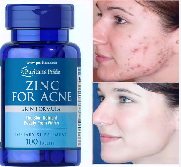 Kẽm Zinc For Acne Puritan's Pride hỗ trợ ngừa mụn 100 viên