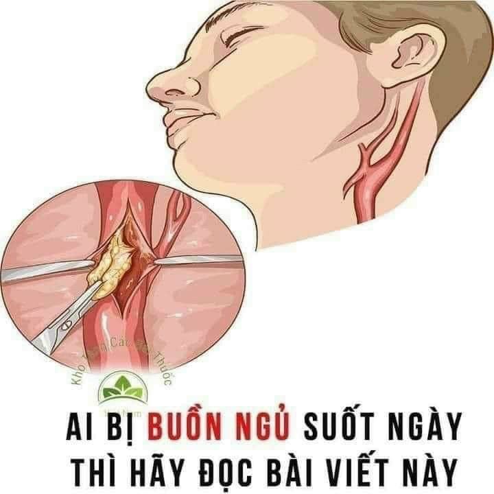 👉📣VÌ SAO BUỒN NGỦ CẢ NGÀY .💔🔊📣💝