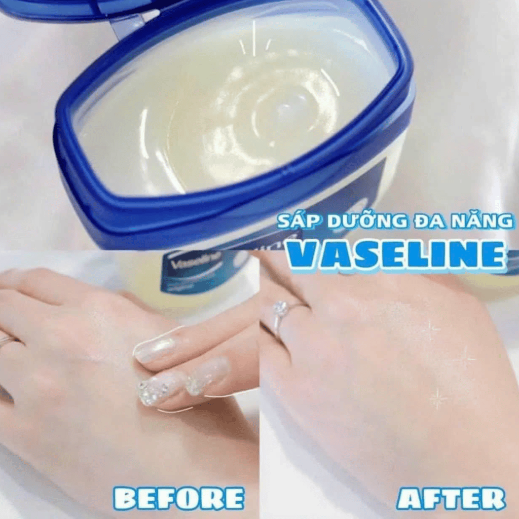 Vaseline Dưỡng Ẩm Blue Seal - 368g