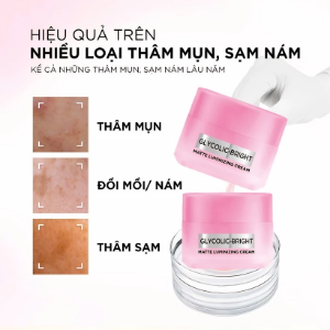 L'Oréal Paris Kem Dưỡng Da Glycolic Bright Matte Luminizing 30ml