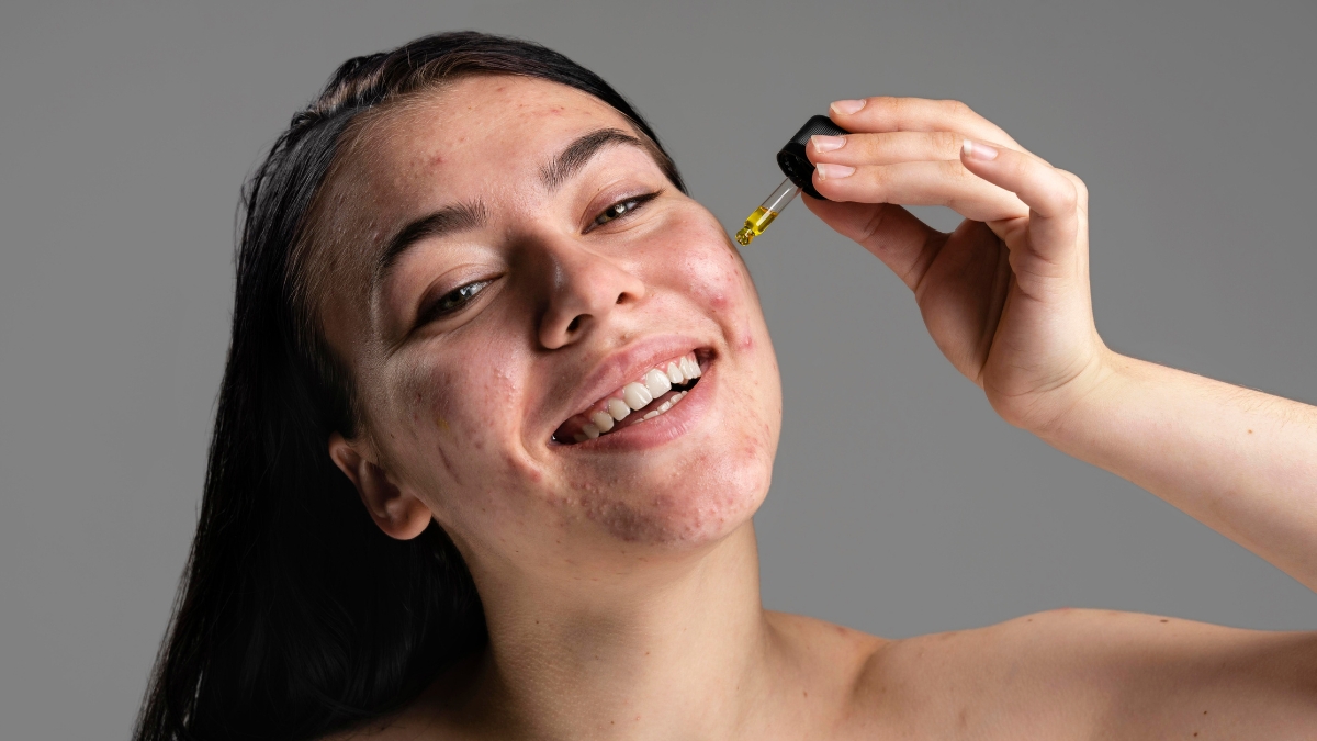 Da dầu mụn nên dùng gì? Gợi ý routine chăm sóc da dầu mụn khoa học