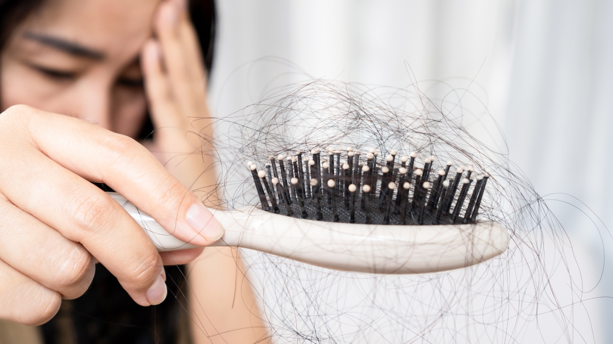 Rụng tóc nhiều là bệnh gì? Lý do rụng tóc thường gặp nhất ở cả 2 giới