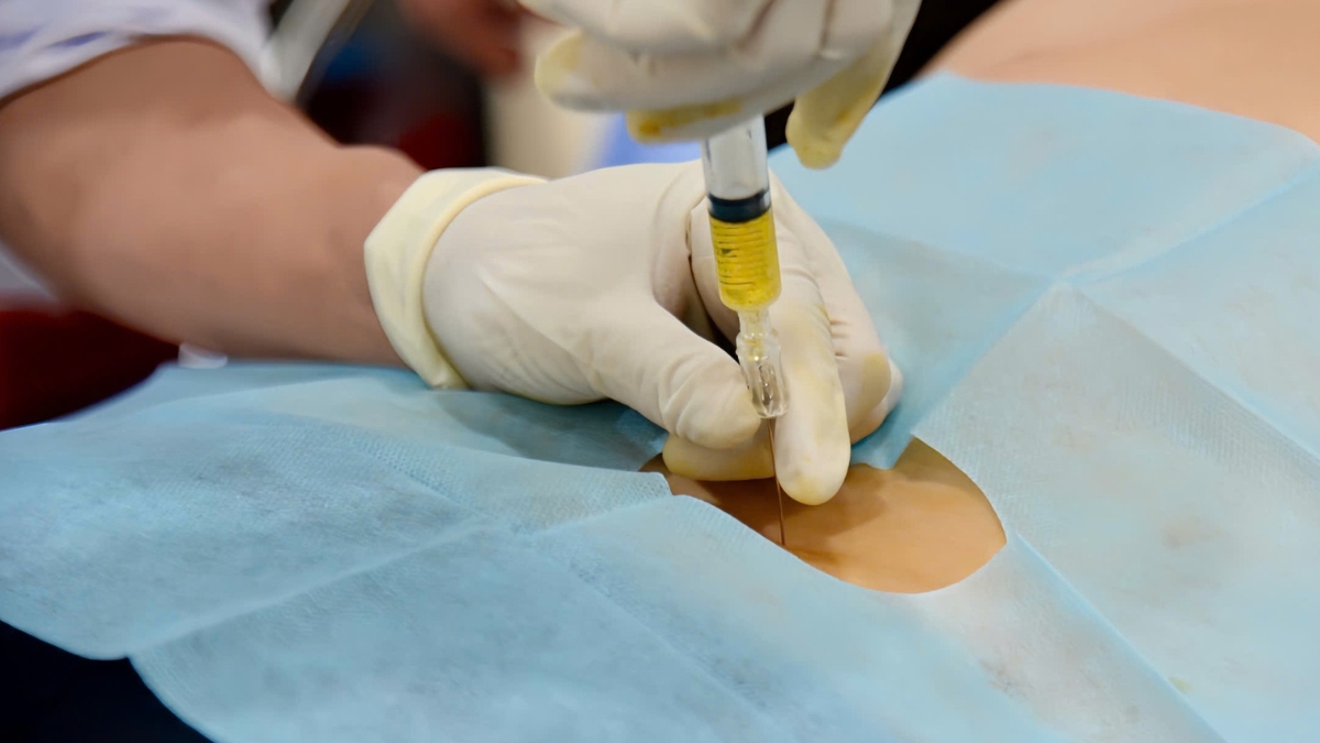 PRP có tác dụng gì trong điều trị thoái hóa cột sống thắt lưng