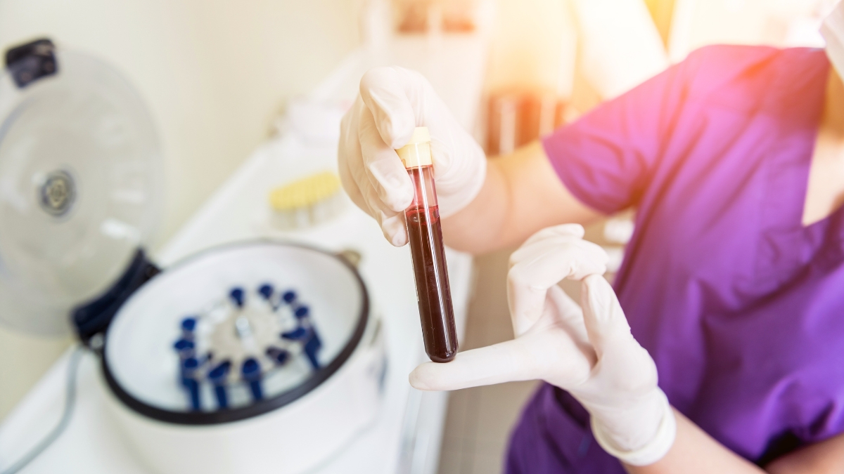 PRP treatment là gì? Ứng dụng PRP treatment trong lành vết thương