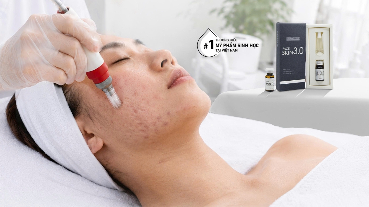 Sẹo rỗ có trị hết được không? Cách điều trị và chăm sóc chuẩn y khoa