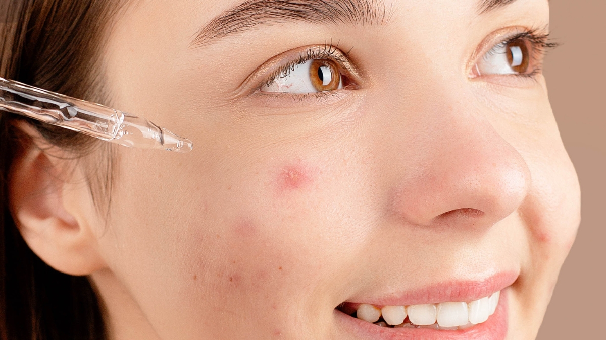 05 tình trạng da nên dùng serum tế bào gốc phục hồi da hư tổn