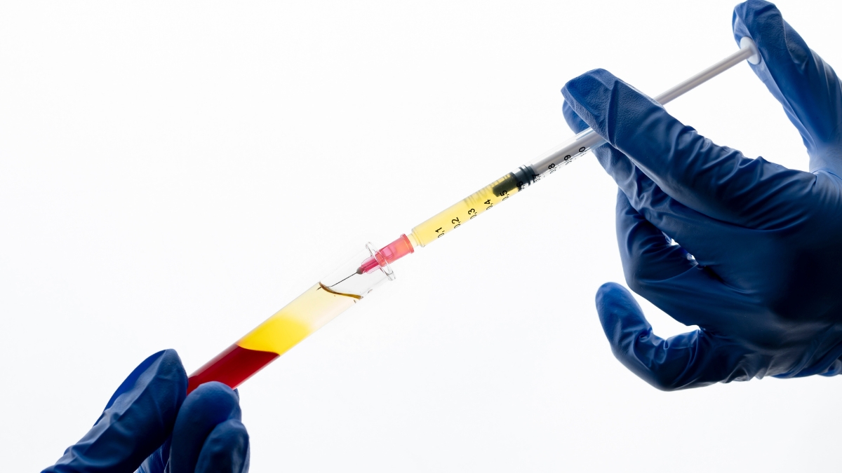 Tiêm PRP điều trị thoái hóa khớp háng do lão hóa & nguyên nhân khác