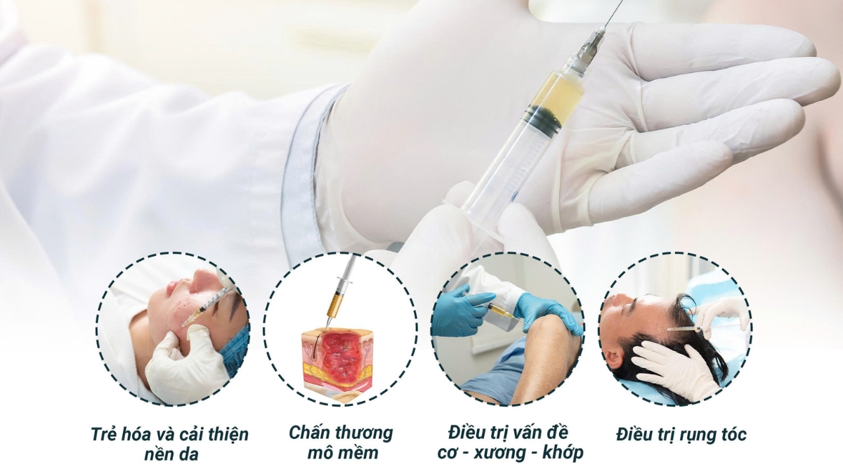 Tiêm huyết tương giàu tiểu cầu có tốt không? Những ai nên tiêm?