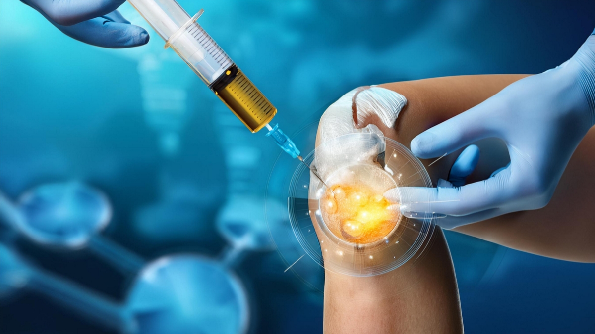 Tiêm prp điều trị thoái hóa khớp bao lâu có tác dụng?