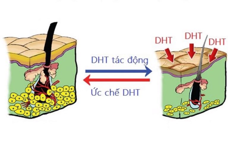 cham dut rung toc sau sinh bang thao duoc 1