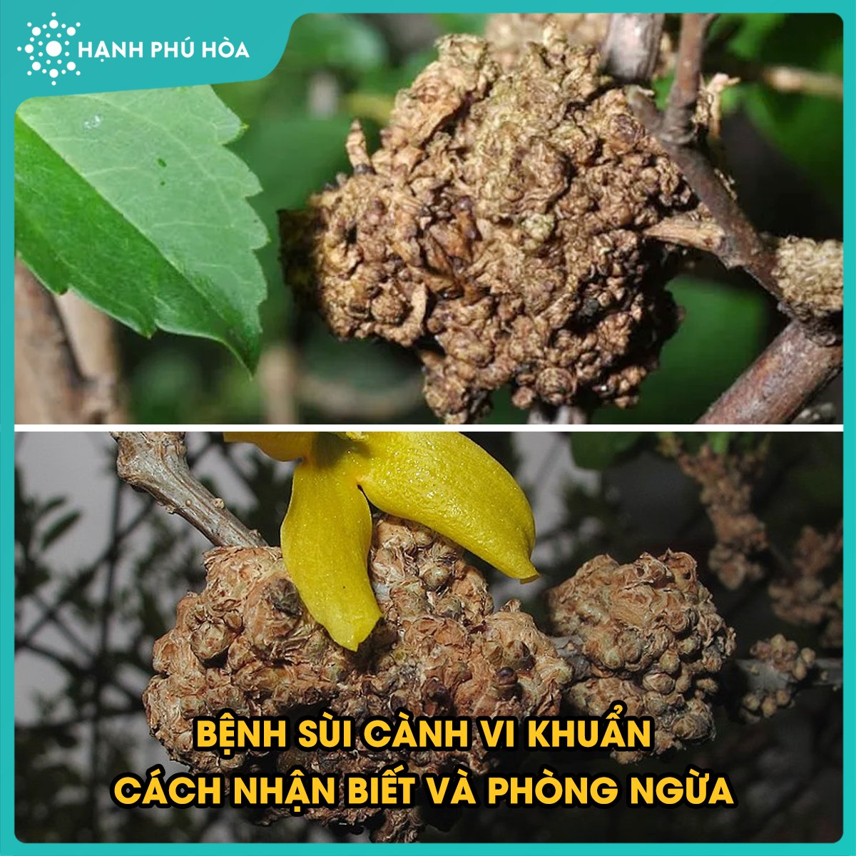 BỆNH SÙI CÀNH VI KHUẨN