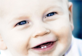 Đề phòng sâu răng ở trẻ