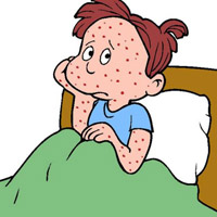 Bài thuốc trị Thủy đậu của danh y Tuệ Tĩnh