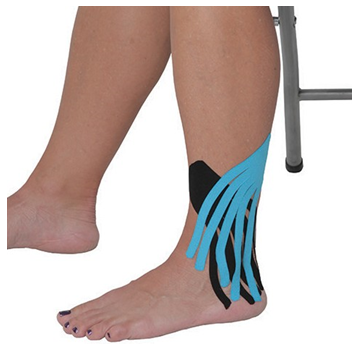 Kinesio Taping hỗ trợ chấn thương bong gân