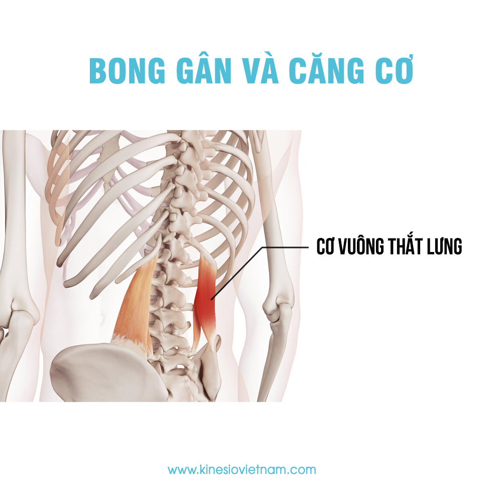 Bong gân và Căng cơ