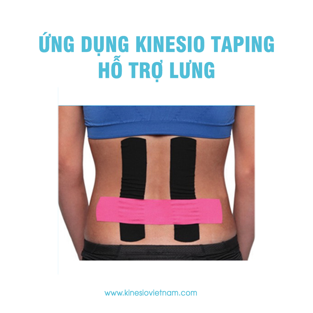 Ứng dụng Kinesio Taping 