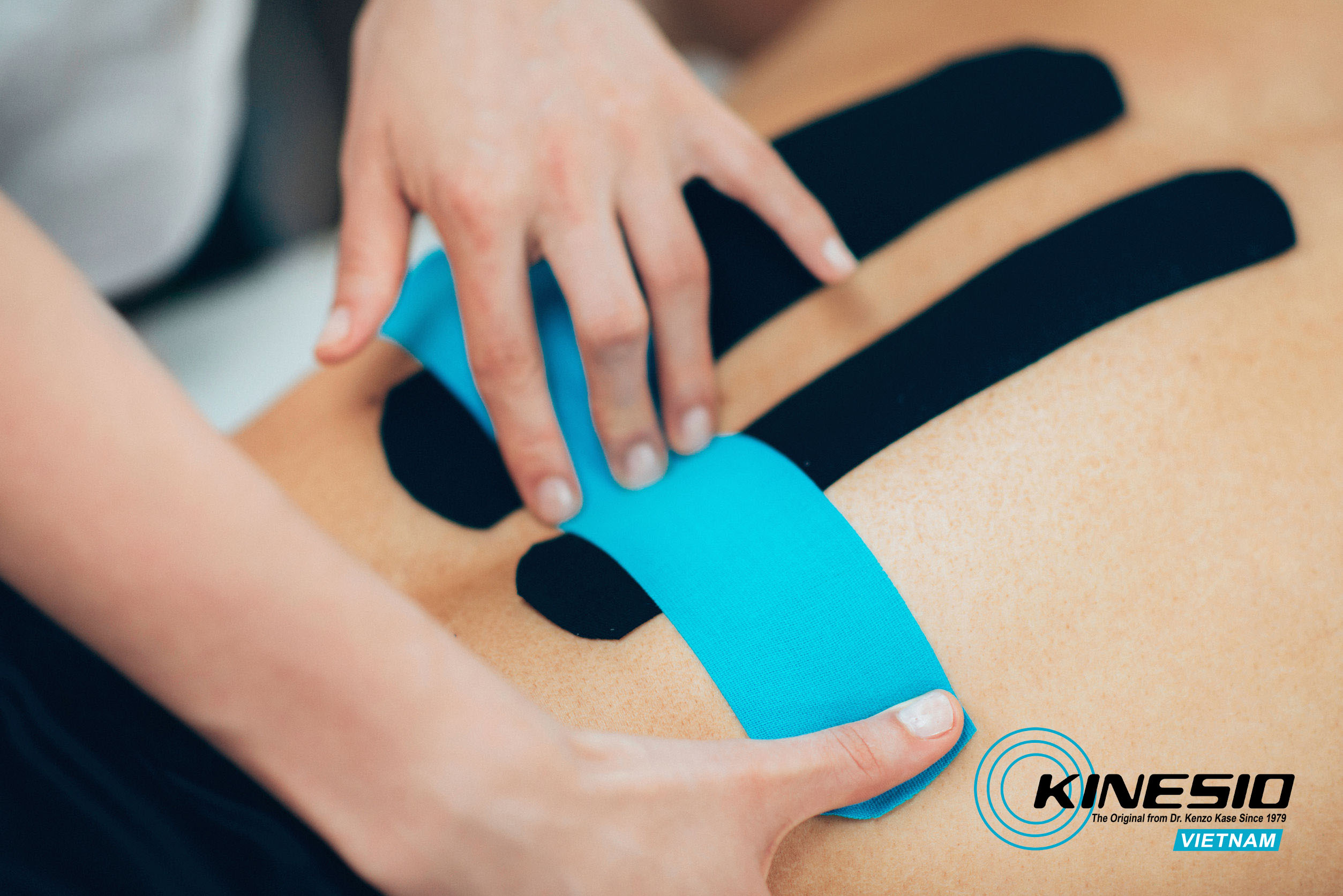 Phương pháp Kinesio Taping