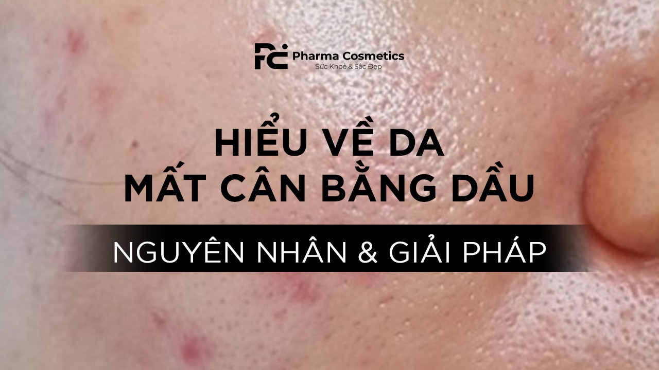 Hiểu Về Da Mất Cân Bằng Dầu: Nguyên Nhân và Giải Pháp