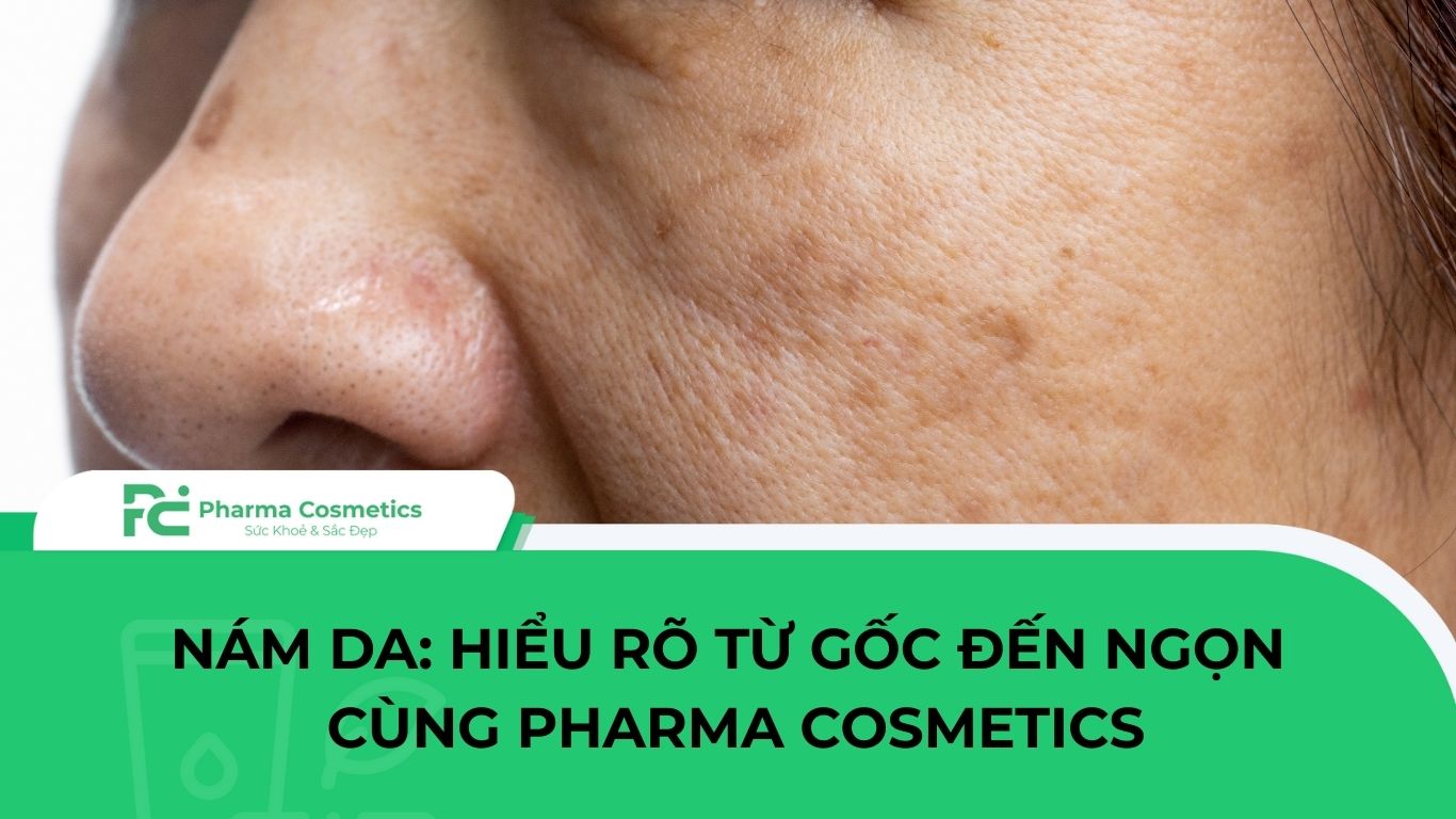 NÁM DA: HIỂU RÕ TỪ GỐC ĐẾN NGỌN CÙNG PHARMA COSMETICS