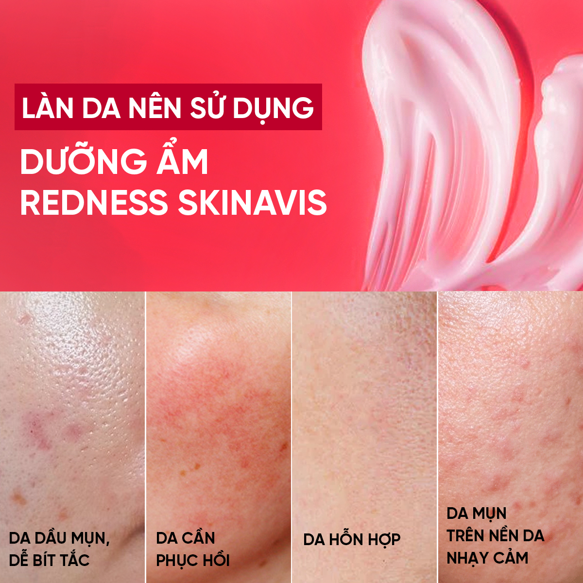 SKINAVIS ADVANCE REDNESS CREAM: Kem Dưỡng Ẩm Chuyên Sâu, Làm Dịu & Giảm Mẩn Đỏ Cho Da Nhạy Cảm
