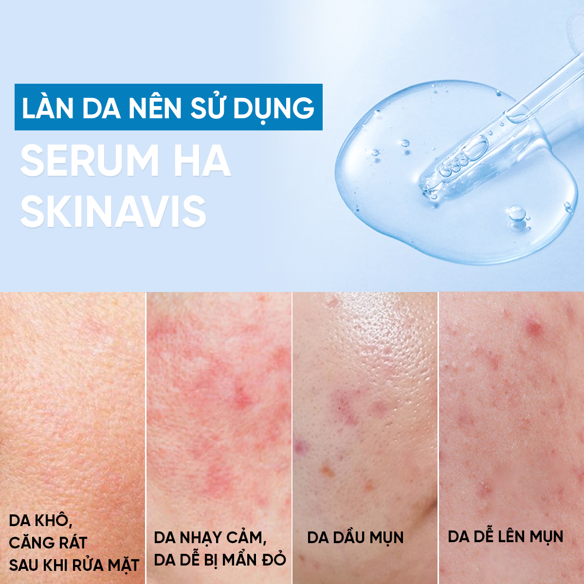 SKINAVIS HYALURONIC ACID SERUM: Cấp Ẩm Đa Tầng, Phục Hồi & Làm Dịu Làn Da Khô, Nhạy Cảm