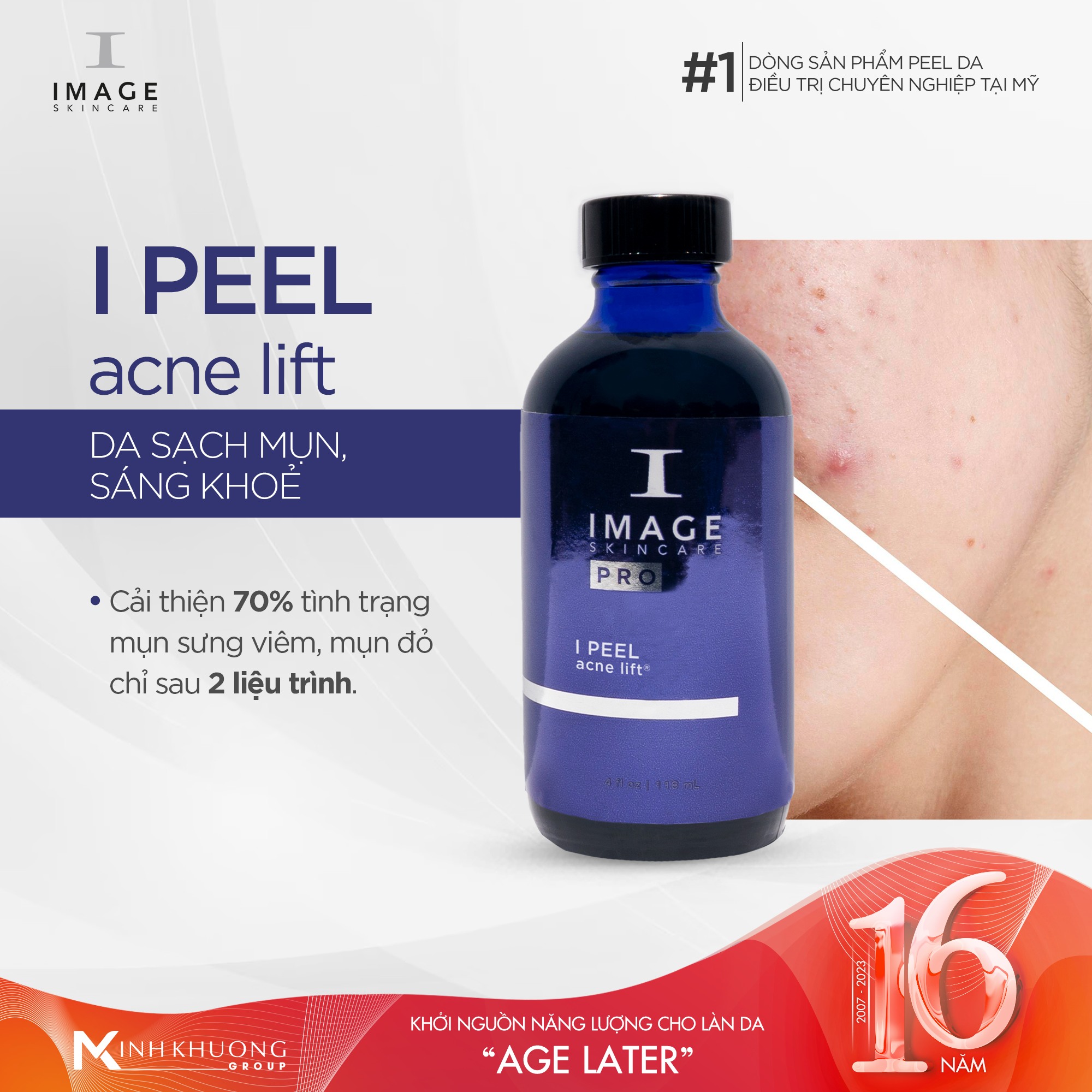 ACNE LIFT® THANH LỌC DA: Chấm Dứt Tình Trạng Bít Tắc và Mụn Ẩn