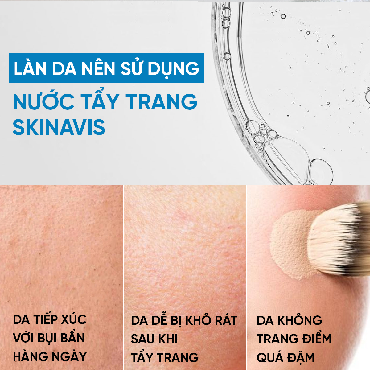 Skinavis Micellar Water: Nước Tẩy Trang Dịu Nhẹ - Sạch Sâu & Không Gây Khô Da