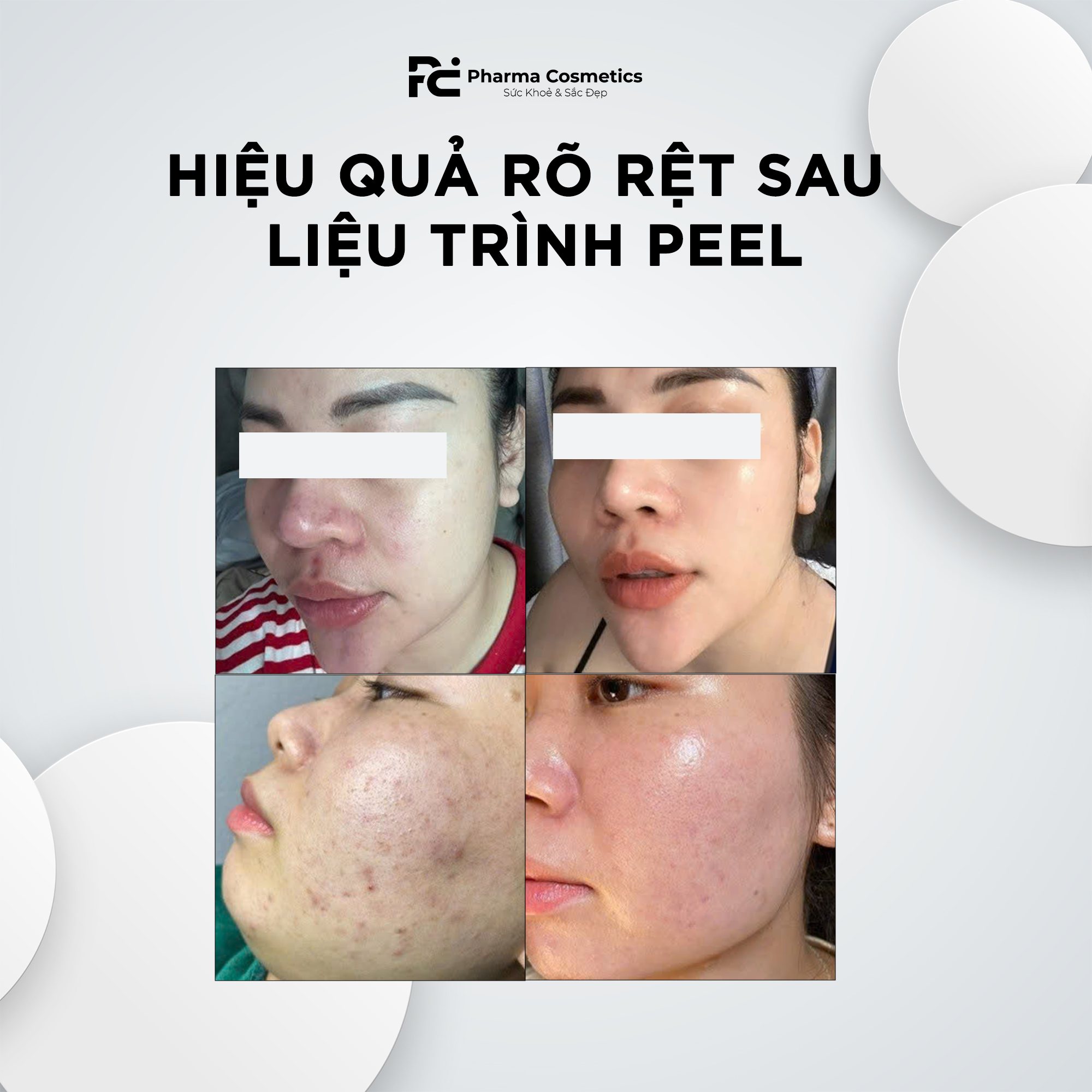 RADIANCE BEAUVA MELA RETINOIC PRO – Đánh Thức Làn Da Rạng Rỡ, Tạm Biệt Sạm Nám!