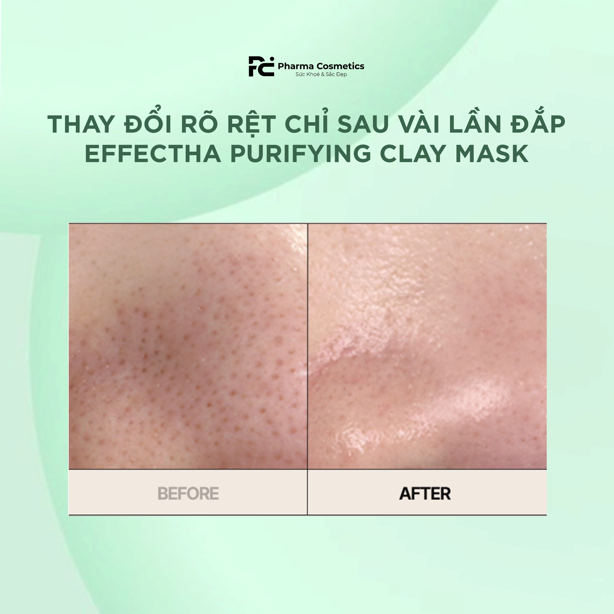 EFFECTHA PURIFYING CLAY MASK / MẶT NẠ ĐẤT SET THẢI ĐỘC DA