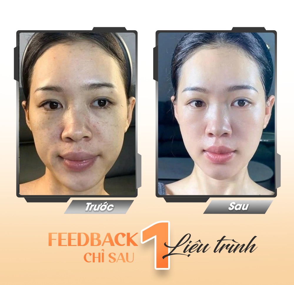 LINERASE COLLAGEN: ĐỈNH CAO TRẺ HÓA SINH HỌC CHUẨN Y KHOA TỪ CHÂU ÂU