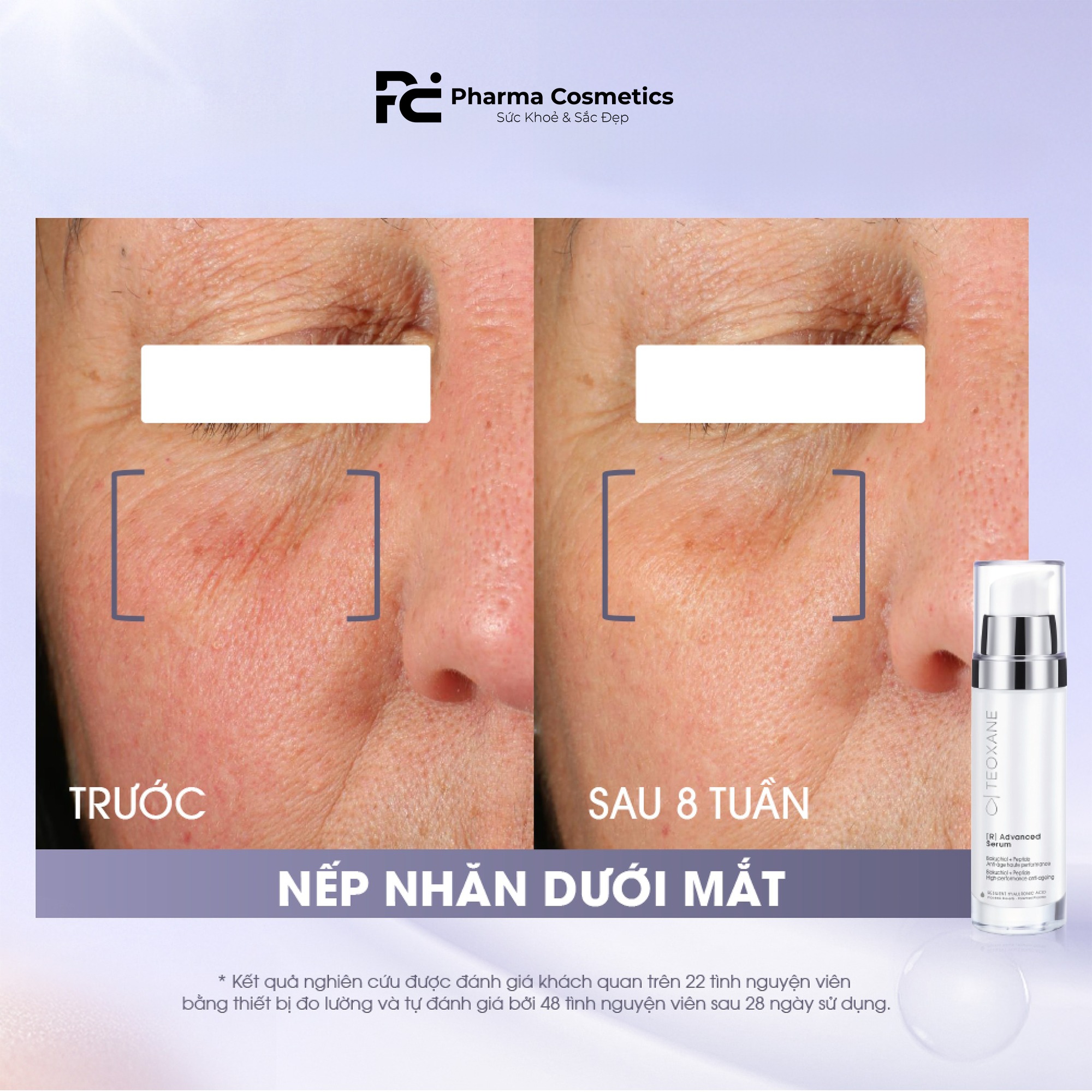 TEOXANE [R] ADVANCED SERUM: Tinh Chất Chống Lão Hóa Thế Hệ Mới - Hiệu Quả Tương Đương Retinol, Không Kích Ứng