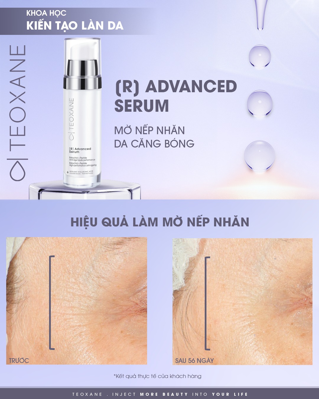 TEOXANE [R] ADVANCED SERUM: Tinh Chất Chống Lão Hóa Thế Hệ Mới - Hiệu Quả Tương Đương Retinol, Không Kích Ứng