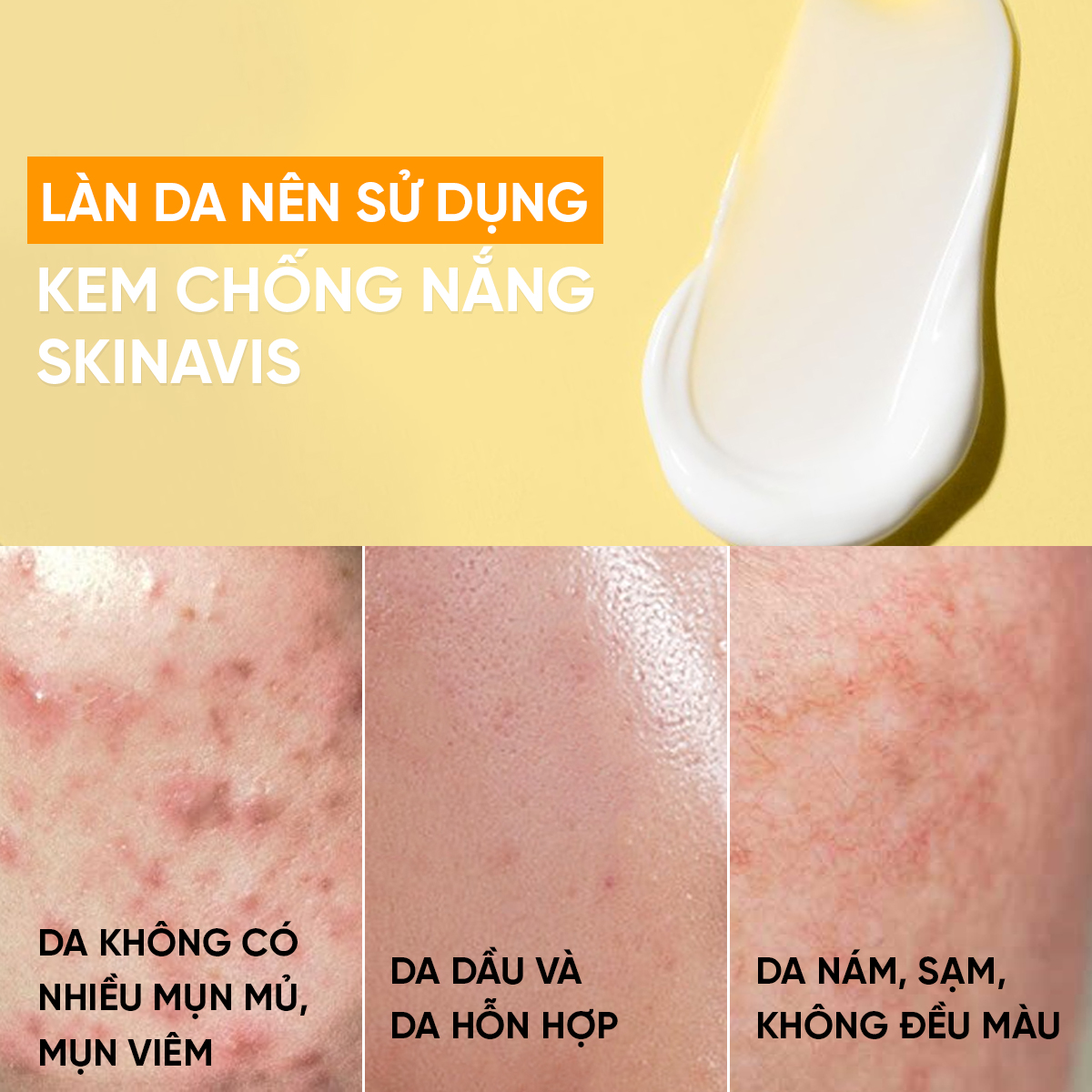 SKINAVIS SUNSCREEN DEFENSE: Kem Chống Nắng Phổ Rộng, Bảo Vệ Toàn Diện & Dưỡng Ẩm Khô Thoáng
