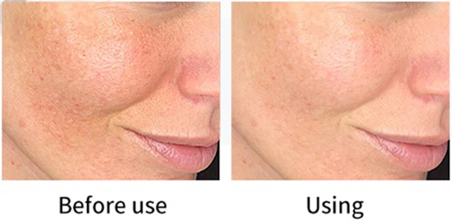 PHARMAFORM C-SMOOTHING SERUM: Tinh Chất Tái Tạo & Sáng Da - Đánh Bay Thâm Nám, Cho Làn Da Mịn Màng