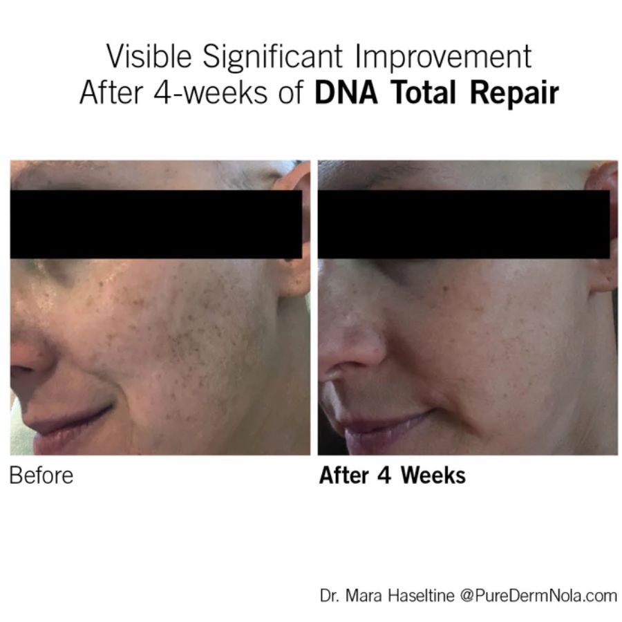 NEOVA DNA TOTAL REPAIR / SERUM CHỐNG OXY HÓA, XÓA NHĂN, GIẢM NÁM