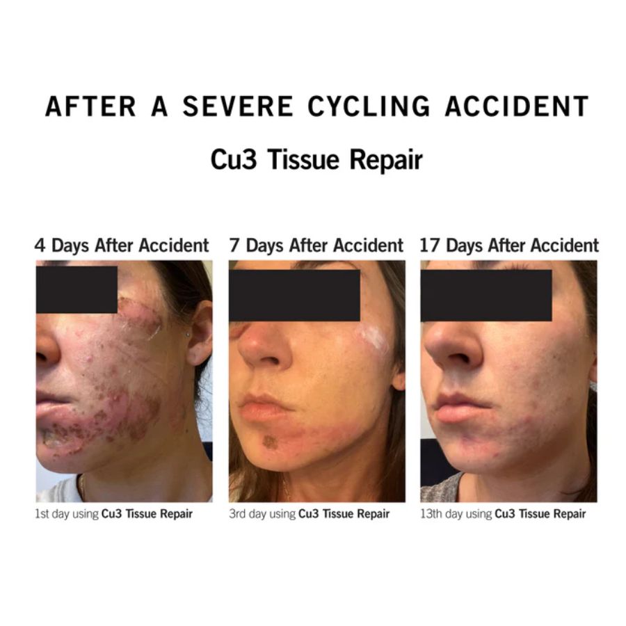 NEOVA CU3 TISSUE REPAIR COPPER PEPTIDE COMPLEX / KEM DƯỠNG PHỤC DA SAU LASER, MESO, BỎNG