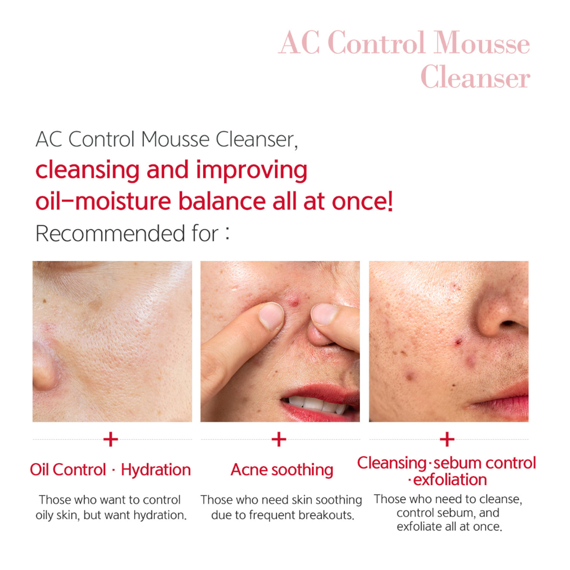 Dr.esthe AC Mousse Cleanser – Sữa Rửa Mặt Dạng Bọt Kiểm Soát Dầu & Ngừa Mụn Chuyên Sâu