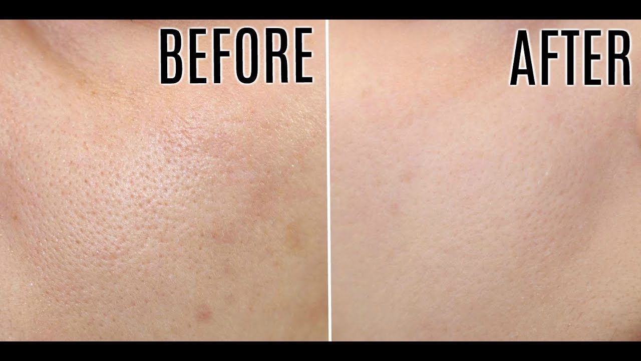 PHARMAFORM ENZYME CLEANSER GEL: Sữa Rửa Mặt Tẩy Da Chết & Cấp Ẩm Dịu Nhẹ