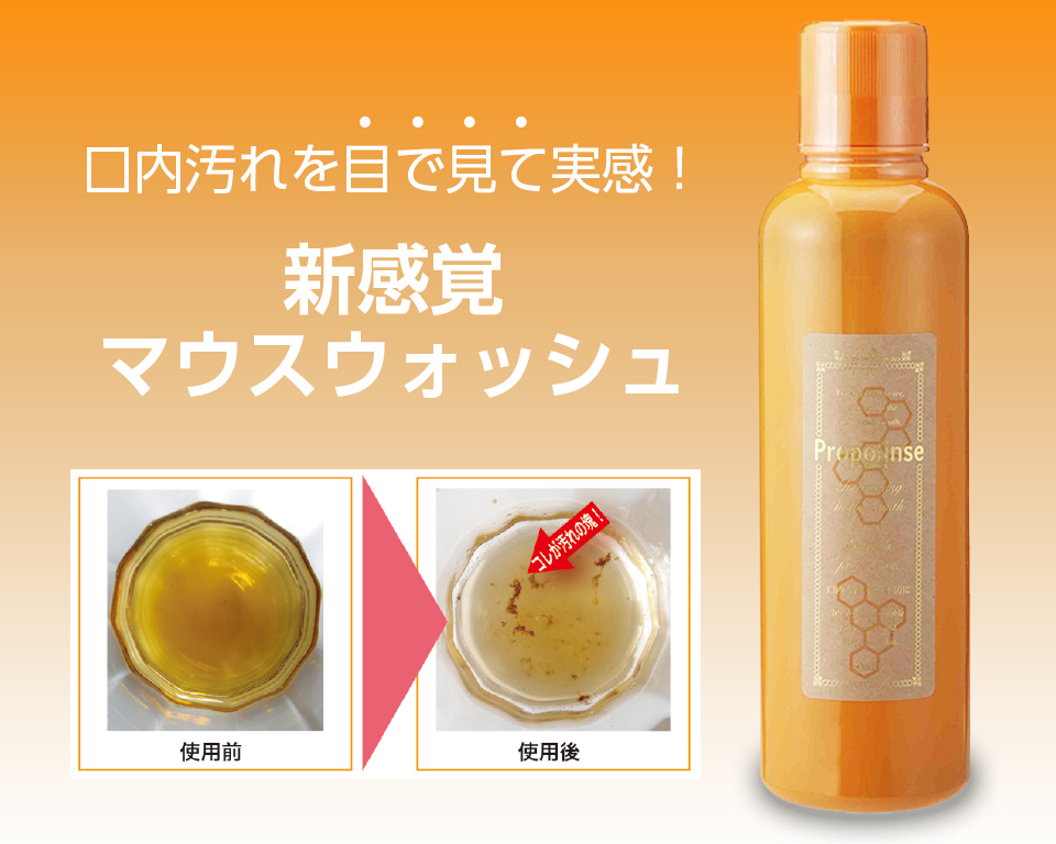 PROPOLINSE PURE: Nước Súc Miệng Sạch Mảng Bám, Cho Hơi Thở Thơm Mát Dài Lâu