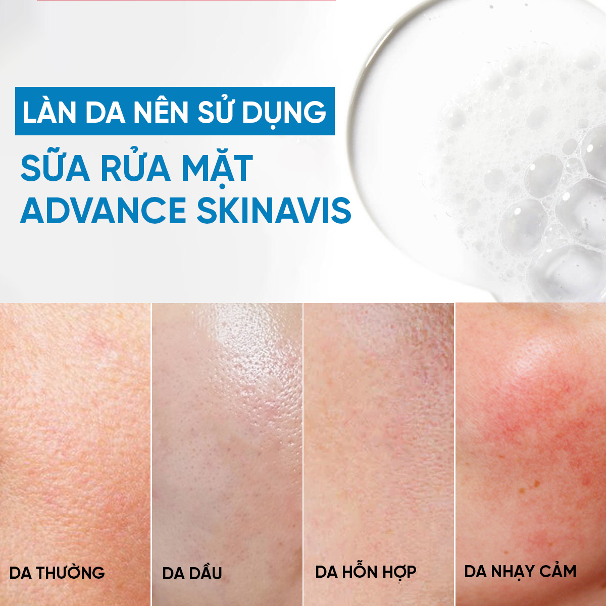 SKINAVIS SOOTHING CLEANSING GEL: Sữa Rửa Mặt Dịu Nhẹ, Cân Bằng pH Cho Làn Da Sạch Khỏe