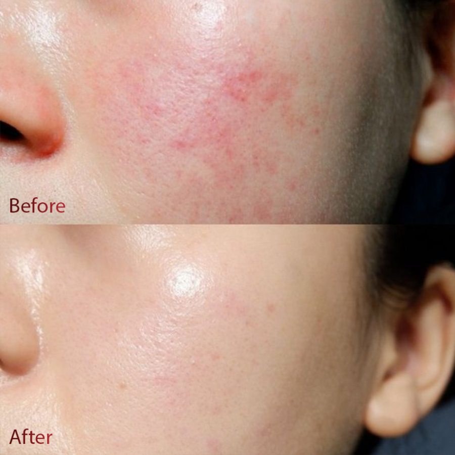DR.DIFFERENT CICA METAL SERUM / SERUM LÀM DỊU, TĂNG CƯỜNG ĐỀ KHÁNG, PHỤC HỒI LÀN DA