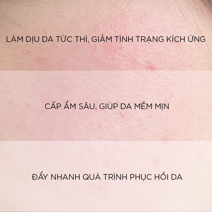 DR.DIFFERENT HYALURON COOL SOOTHING CREAM / KEM DƯỠNG ẨM VÀ LÀM DỊU DA TỨC THÌ 