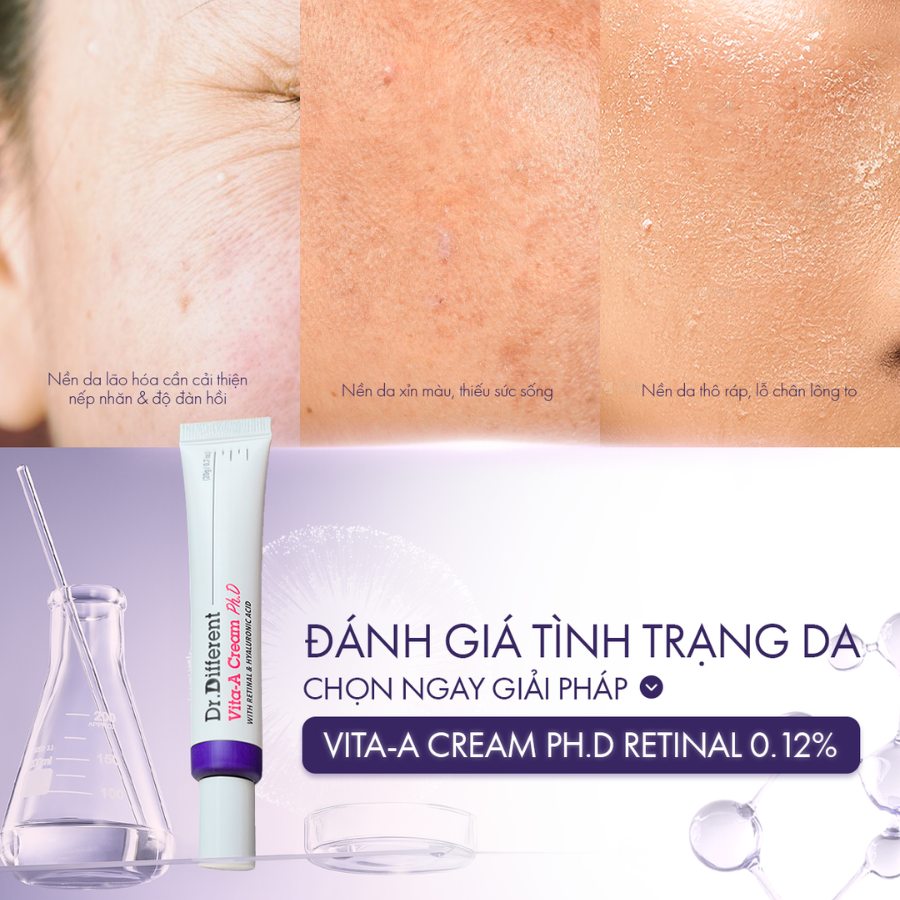 DR.DIFFERENT VITA A CREAM PH.D / KEM DƯỠNG CHỐNG LÃO HÓA, CẢI THIỆN NẾP NHĂN, GIẢM CHẠY XỆ (RETINAL 0.12%)