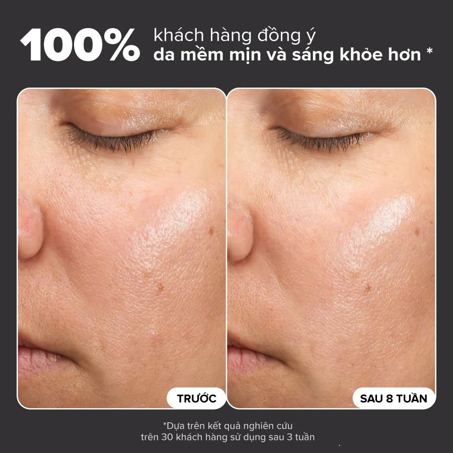 PAULA’S CHOICE SKIN PERFECTING 6% MANDELIC ACID + 2% LACTIC ACID LIQUID EXFOLIANT: Tái Tạo Làn Da Mềm Mịn & Rạng Rỡ