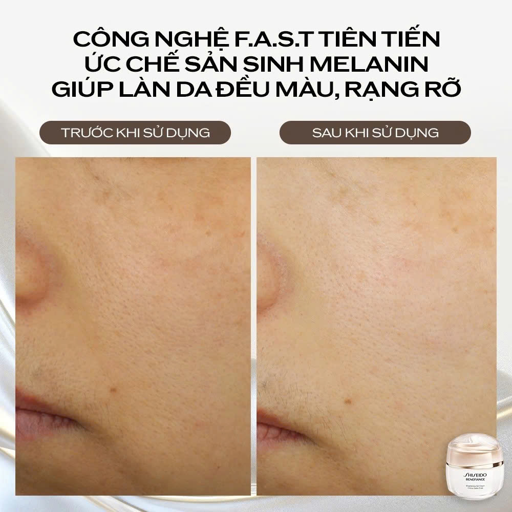 SHISEIDO BENEFIANCE BRIGHTENING GEL CREAM: Gel Dưỡng Trắng Sáng, Cải Thiện Da Không Đều Màu