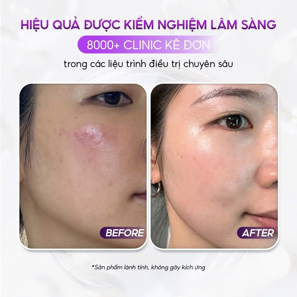 VQM Phytocin Hybrid Cream : Kem Dưỡng Ẩm & Phục Hồi Da Chuyên Sâu, Cải Thiện Mụn & Kích Ứng