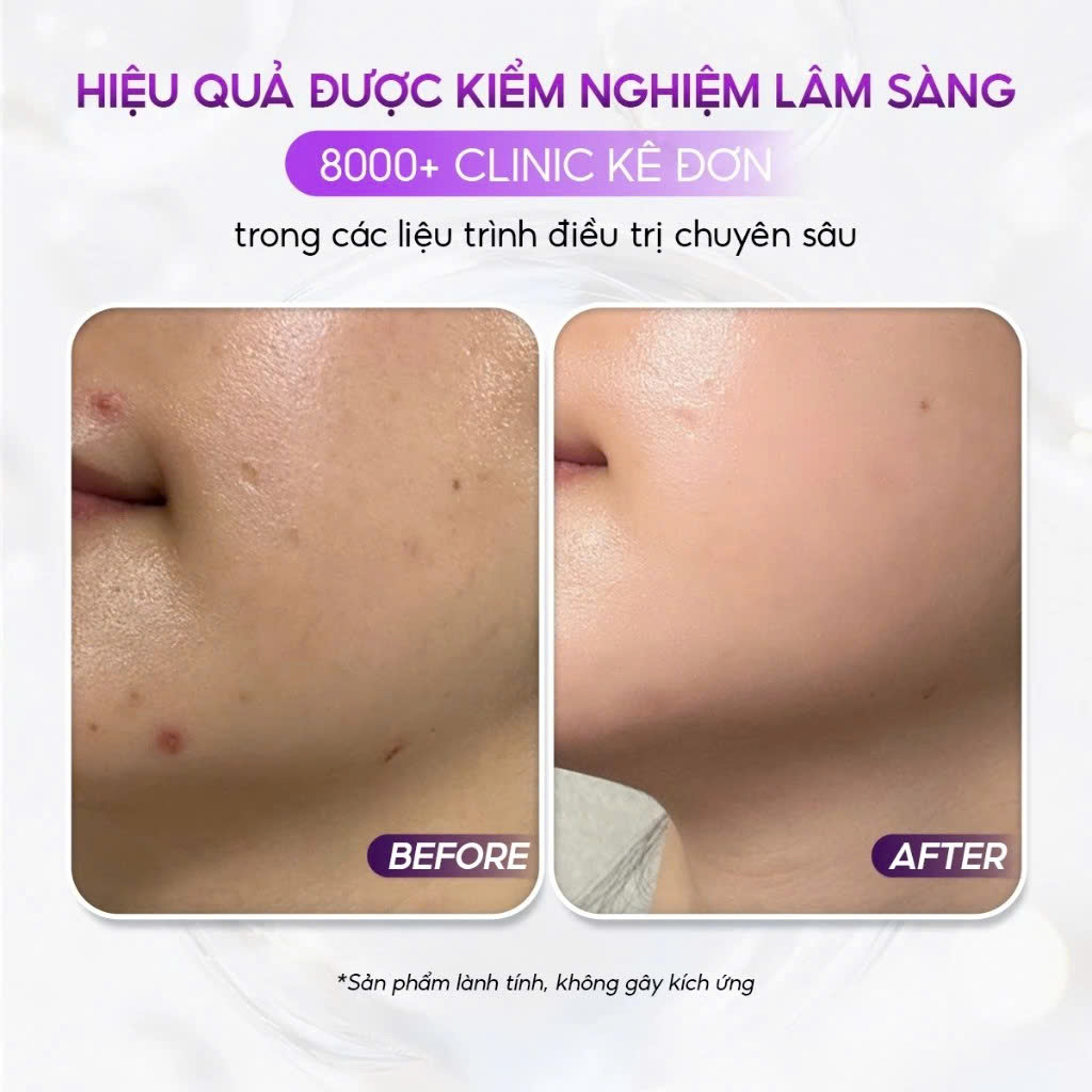 VQM Phytocin Hybrid Cream : Kem Dưỡng Ẩm & Phục Hồi Da Chuyên Sâu, Cải Thiện Mụn & Kích Ứng