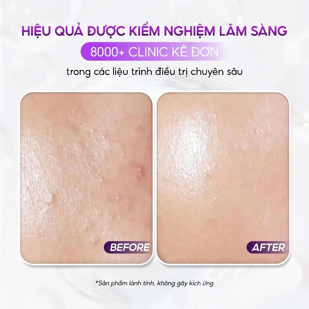 VQM Phytocin Hybrid Cream : Kem Dưỡng Ẩm & Phục Hồi Da Chuyên Sâu, Cải Thiện Mụn & Kích Ứng