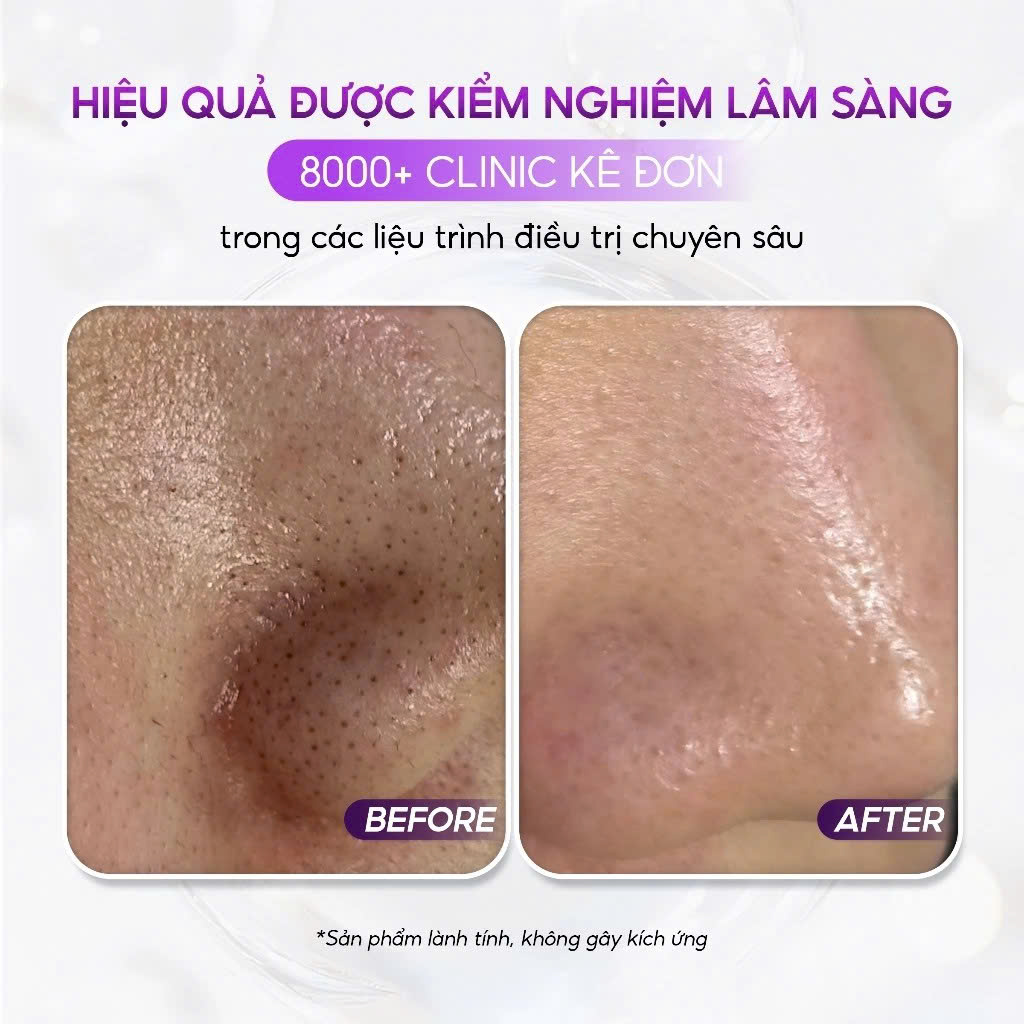 aXENDA ROUTINER: Sáp Peel Da Sinh Học - Tái Tạo & Phục Hồi Làn Da Ngay Trong Giấc Ngủ