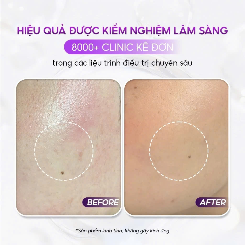 CONAPIDIL LOTION POLISHING: Dầu Rửa Mặt Sạch Sâu & Kháng Khuẩn, Dịu Nhẹ Cho Mọi Làn Da